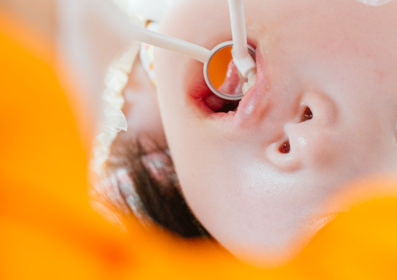 日々のリハビリテーション